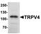 Transient Receptor Potential Cation Channel Subfamily V Member 4 antibody, LS-B10184, Lifespan Biosciences, Western Blot image 