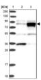 Hyaluronan mediated motility receptor antibody, NBP2-38459, Novus Biologicals, Western Blot image 