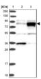 Hyaluronan Mediated Motility Receptor antibody, NBP2-38459, Novus Biologicals, Western Blot image 