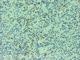 MUM1 antibody, ab12501, Abcam, Immunohistochemistry paraffin image 