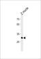 H6 Family Homeobox 3 antibody, PA5-72623, Invitrogen Antibodies, Western Blot image 