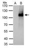 Elongator Acetyltransferase Complex Subunit 2 antibody, GTX121449, GeneTex, Immunoprecipitation image 