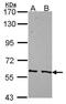 Protein Phosphatase 3 Catalytic Subunit Gamma antibody, PA5-30129, Invitrogen Antibodies, Western Blot image 