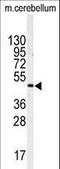 Inositol-Trisphosphate 3-Kinase A antibody, LS-C100941, Lifespan Biosciences, Western Blot image 