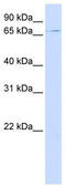 Sad1 And UNC84 Domain Containing 2 antibody, TA341972, Origene, Western Blot image 