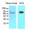 Dishevelled Binding Antagonist Of Beta Catenin 3 antibody, AM09054PU-N, Origene, Western Blot image 