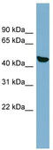 RNA 2',3'-Cyclic Phosphate And 5'-OH Ligase antibody, TA345114, Origene, Western Blot image 