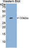 Adenylate Cyclase 9 antibody, LS-C292648, Lifespan Biosciences, Western Blot image 