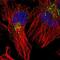 Acyl-CoA Synthetase Long Chain Family Member 4 antibody, NBP2-55119, Novus Biologicals, Immunocytochemistry image 