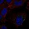 Sphingosine-1-Phosphate Receptor 1 antibody, NBP2-58024, Novus Biologicals, Immunocytochemistry image 