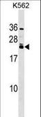 Heart And Neural Crest Derivatives Expressed 2 antibody, LS-C166783, Lifespan Biosciences, Western Blot image 