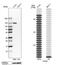 Integrin Subunit Alpha 6 antibody, NBP1-85747, Novus Biologicals, Western Blot image 