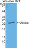 Fibroblast Growth Factor 21 antibody, LS-C314937, Lifespan Biosciences, Western Blot image 