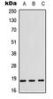 Cofilin 1 antibody, LS-C358939, Lifespan Biosciences, Western Blot image 