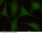 Calmodulin Like 3 antibody, 12480-MM03, Sino Biological, Immunohistochemistry frozen image 