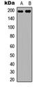 DNA Topoisomerase II Alpha antibody, LS-C368557, Lifespan Biosciences, Western Blot image 