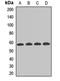 Aldehyde Dehydrogenase 6 Family Member A1 antibody, orb412174, Biorbyt, Western Blot image 