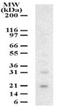 Deoxyuridine Triphosphatase antibody, GTX13690, GeneTex, Western Blot image 