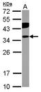 Phosphatidylinositol Transfer Protein Beta antibody, LS-C155595, Lifespan Biosciences, Western Blot image 