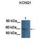 Potassium Voltage-Gated Channel Subfamily Q Member 1 antibody, orb329798, Biorbyt, Western Blot image 