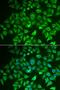 BRCA1 DNA Repair Associated antibody, orb338847, Biorbyt, Immunofluorescence image 