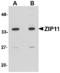Zinc transporter ZIP11 antibody, LS-B3871, Lifespan Biosciences, Western Blot image 