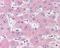 Solute Carrier Family 3 Member 2 antibody, 49-812, ProSci, Immunohistochemistry paraffin image 