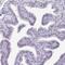 mNIFK antibody, HPA035735, Atlas Antibodies, Immunohistochemistry paraffin image 