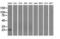 Proteasome 26S Subunit, Non-ATPase 10 antibody, GTX83773, GeneTex, Western Blot image 