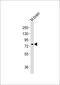 Methyl-CpG Binding Protein 2 antibody, MBS9203046, MyBioSource, Western Blot image 