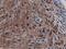 Sequestosome 1 antibody, LS-C337182, Lifespan Biosciences, Immunohistochemistry frozen image 