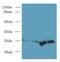 Suppressor Of Cytokine Signaling 3 antibody, MBS968981, MyBioSource, Western Blot image 