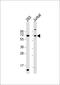 Cytochrome P450 Family 2 Subfamily B Member 6 antibody, 55-629, ProSci, Western Blot image 