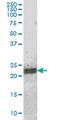 Activating Transcription Factor 3 antibody, MA5-18444, Invitrogen Antibodies, Western Blot image 