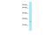 Glutathione S-transferase theta-4 antibody, PA5-69587, Invitrogen Antibodies, Western Blot image 