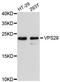 VPS29 Retromer Complex Component antibody, LS-C748161, Lifespan Biosciences, Western Blot image 