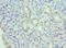 Histone Deacetylase 8 antibody, LS-C375898, Lifespan Biosciences, Immunohistochemistry paraffin image 