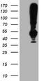 Transmembrane Protein With EGF Like And Two Follistatin Like Domains 2 antibody, CF504555, Origene, Western Blot image 