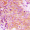 EPS8 Like 3 antibody, LS-C353545, Lifespan Biosciences, Immunohistochemistry paraffin image 