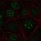 Zinc Finger And BTB Domain Containing 14 antibody, NBP2-57846, Novus Biologicals, Immunofluorescence image 