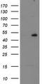 RB Binding Protein 7, Chromatin Remodeling Factor antibody, TA504004S, Origene, Western Blot image 