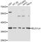 ELOVL Fatty Acid Elongase 4 antibody, MBS128964, MyBioSource, Western Blot image 