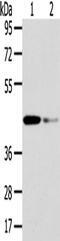 VPS37A Subunit Of ESCRT-I antibody, PA5-51161, Invitrogen Antibodies, Western Blot image 