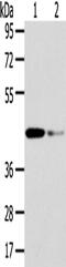 VPS37A Subunit Of ESCRT-I antibody, PA5-51161, Invitrogen Antibodies, Western Blot image 