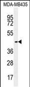 Olfactory Receptor Family 2 Subfamily L Member 13 antibody, PA5-48154, Invitrogen Antibodies, Western Blot image 