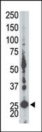 Adenylate Kinase 5 antibody, 63-412, ProSci, Western Blot image 