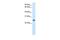 Gamma-Glutamyltransferase Light Chain 1 antibody, GTX47132, GeneTex, Western Blot image 