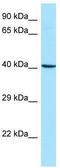 ARPC1B antibody, TA338143, Origene, Western Blot image 