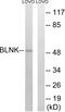 BLNK antibody, LS-C117740, Lifespan Biosciences, Western Blot image 
