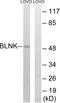 SLP-65 antibody, LS-C117740, Lifespan Biosciences, Western Blot image 